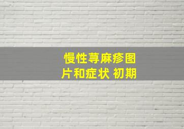 慢性荨麻疹图片和症状 初期